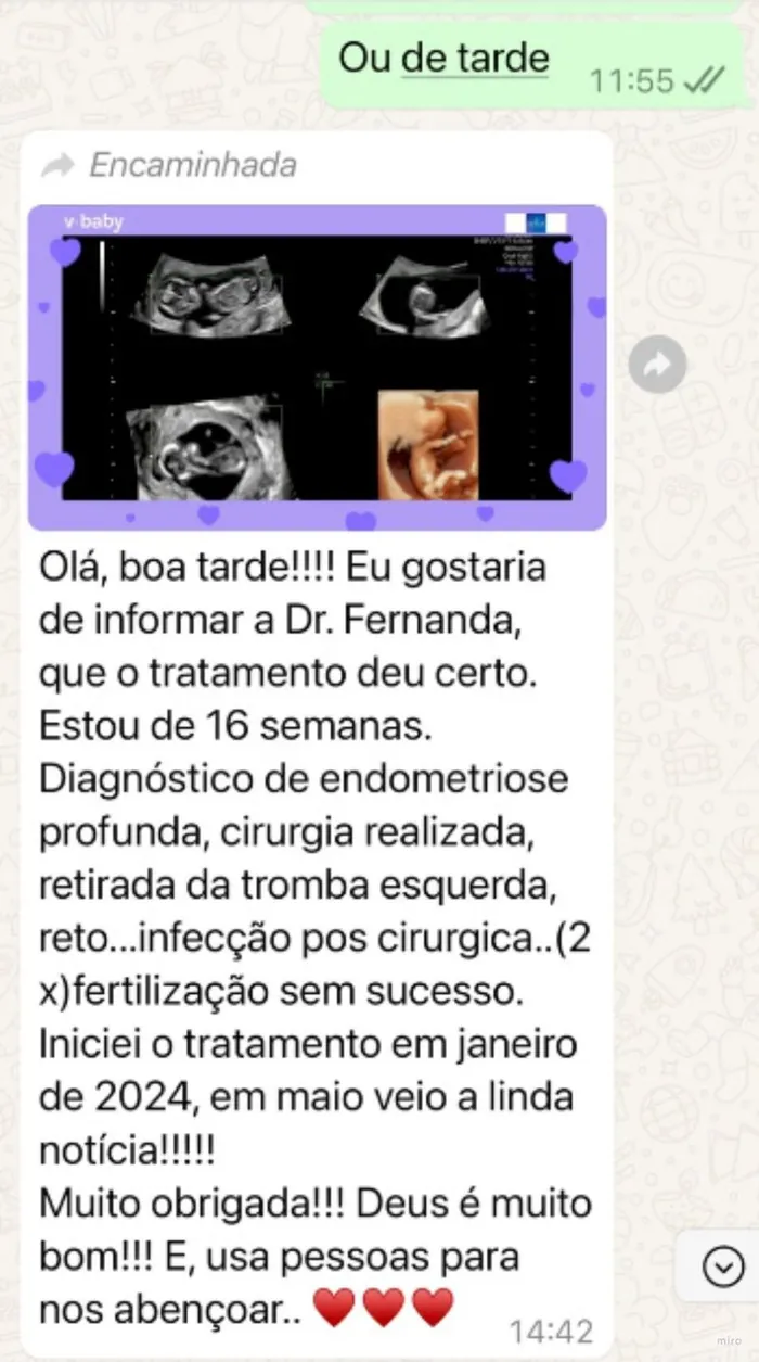 Depoimento – endometriose profunda, gestação após tratamento